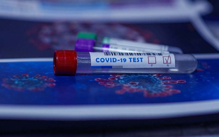 Laboratories where to take a COVID-19 test in Cancún