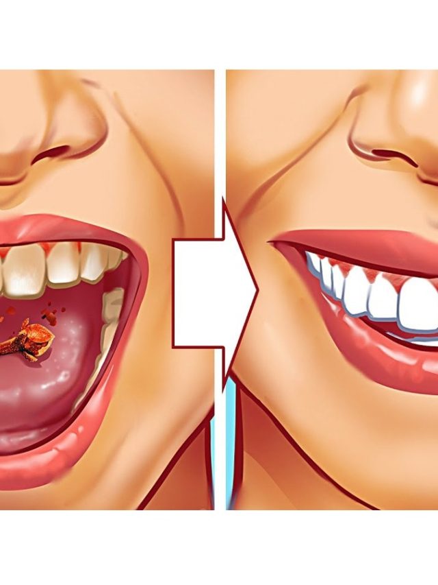 10 Tips To Get Rid Of Tartar In Teeth Naturally