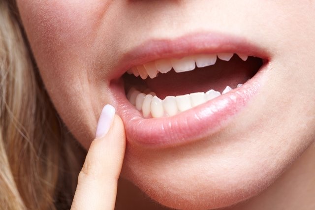 13 home remedies for cold sore (and how to prepare)