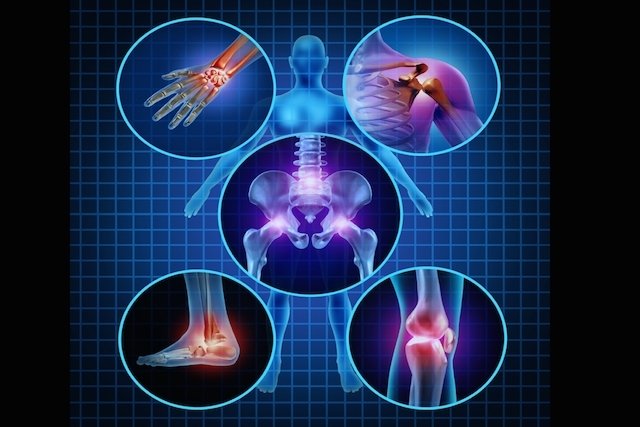 5 treatment options for osteoarthritis