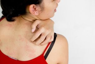 Skin allergy: symptoms, causes, types and treatment