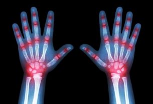 Reactive arthritis: what it is, treatment, symptoms and causes