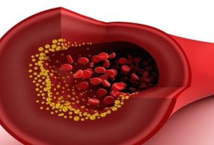 Cholesterol values: LDL, HDL, VLDL and total