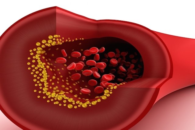 Cholesterol values: LDL, HDL, VLDL and total