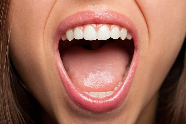 Oral candidiasis: what it is, symptoms, causes and treatment