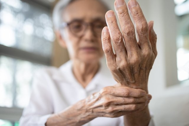 6 main symptoms of rheumatoid arthritis (with online test)