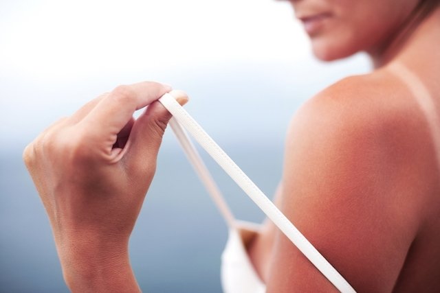 7 tricks to avoid burning spots on your skin