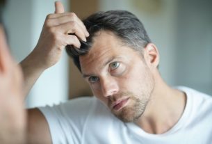 Androgenetic alopecia: what it is, symptoms, causes and treatment