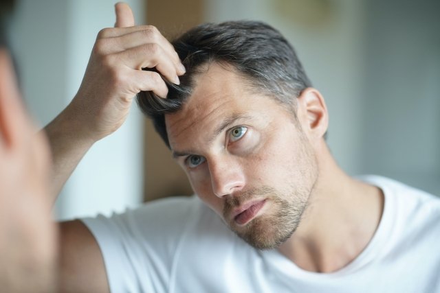 Androgenetic alopecia: what it is, symptoms, causes and treatment