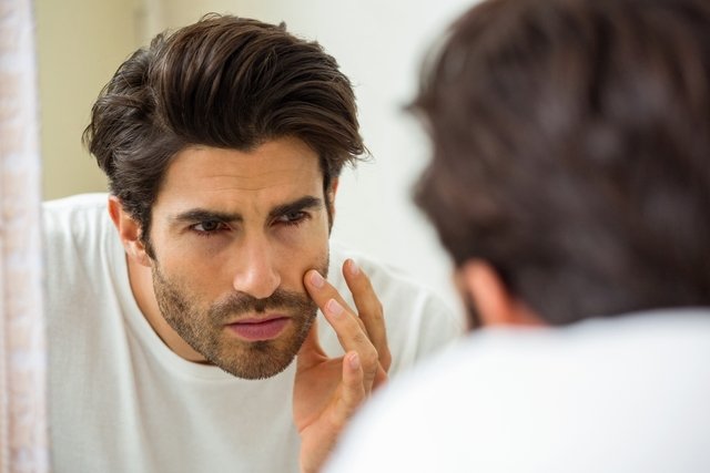 Beard folliculitis: what it is, symptoms, causes and treatment