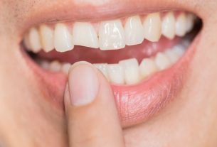 Broken tooth: symptoms, causes and what to do