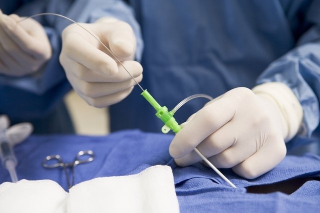 Catheterization: what it is, types and possible risks