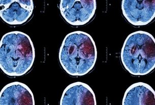 Cerebral hemorrhage: symptoms, causes, treatment and consequences