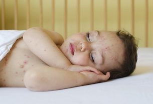 Chickenpox in a baby: symptoms, transmission and treatment