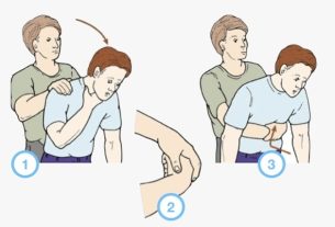 Choking: first aid for choking