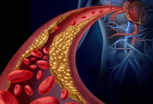 Cholesterol calculator: is your cholesterol good?