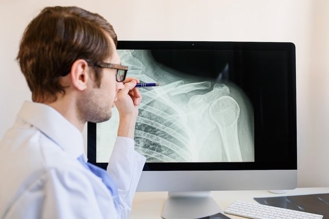 Clavicle fracture: symptoms, causes, types and treatment