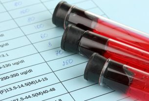 Complete Blood Count: what it is for, results (and common changes)