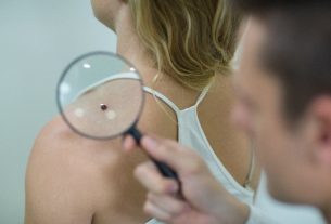 Dermatological examination: what it is and how it is done