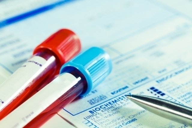 Direct and indirect coombs test: what it is, what it is for and results