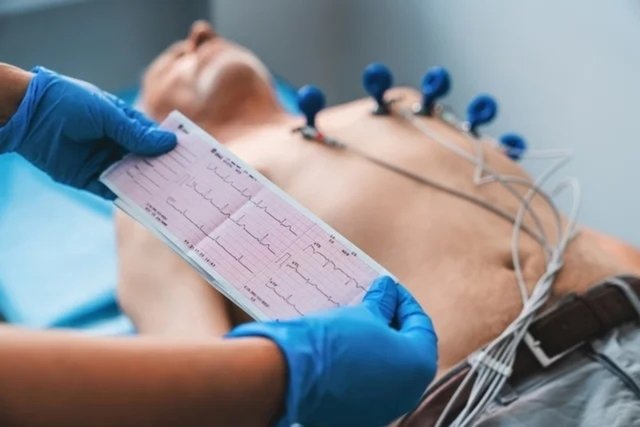 Electrocardiogram: how it is done, results and when it is indicated