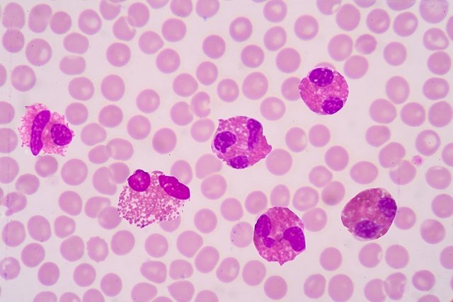 Eosinophils: what they are and why they are high or low