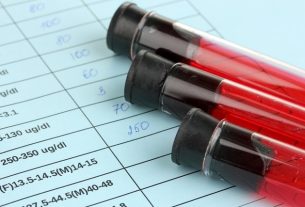 Ferritin: what it is (and why it is high or low)