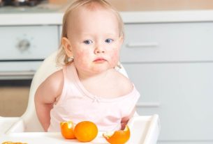 Food allergy in babies: symptoms, causes and what to do