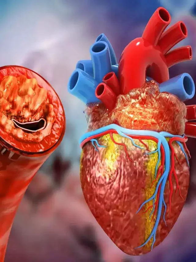 Heart Health: Top 8 Natural Blood Thinners That Can Prevent Stroke