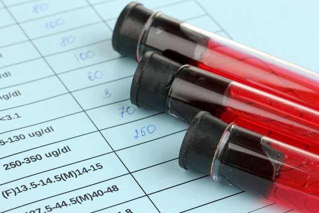 How to understand the TGO-AST exam: Aspartate Aminotransferase