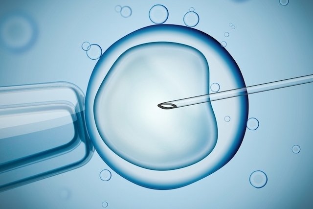 In vitro fertilization (IVF): what it is, when it is indicated and how it is done