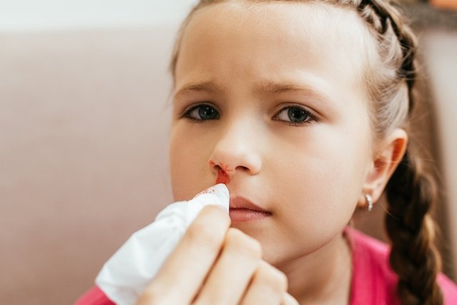 Infant nosebleeds: 6 main causes (and what to do)