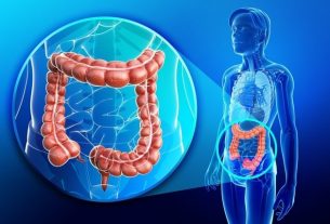 Is bowel cancer curable?  4 treatment options