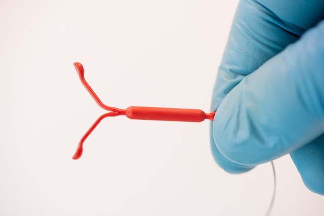 Pregnancy with an IUD: is it really possible?