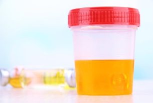 Protein in urine (proteinuria): what it can be, symptoms and treatment