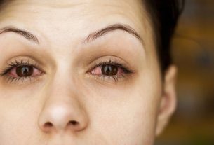 Types of conjunctivitis: bacterial, viral or allergic (and how to confirm)