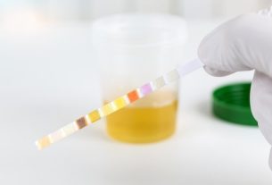 Urine test (EAS): what it is for, preparation and results