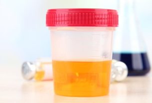 Urobilinogen in urine: what it can be and what to do