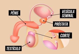 Vasectomy: what it is, how it is done and other common questions