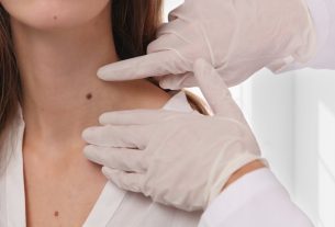 Warts on the neck: what they could be (and what to do)