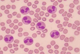 What can be high or low segmented neutrophils