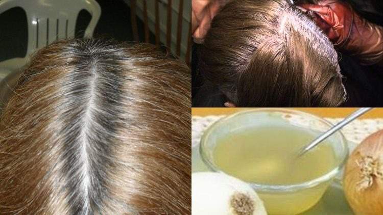 Onion hair tonic against hair loss