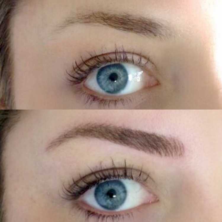 Before and after eyebrow micropigmentation