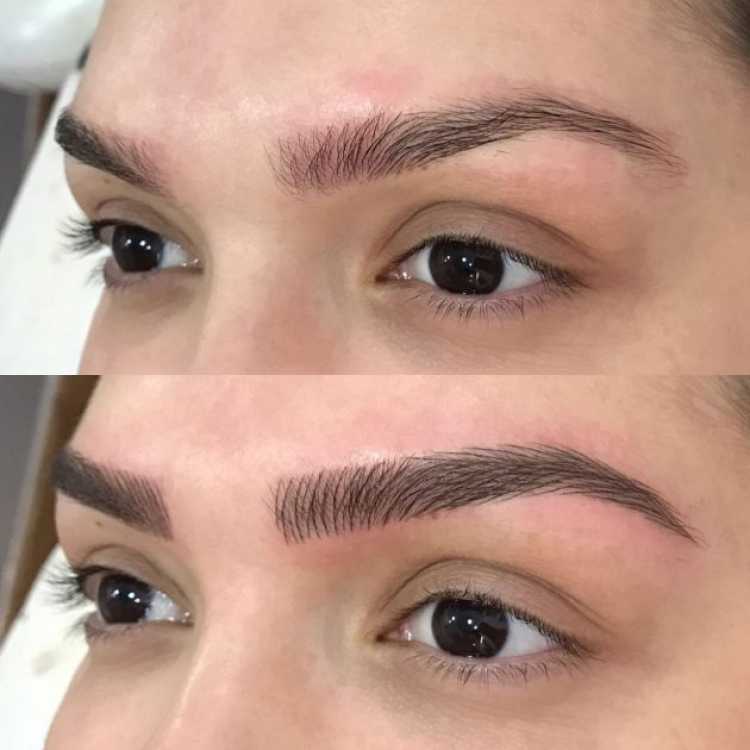 Comparison of before and after eyebrow micropigmentation