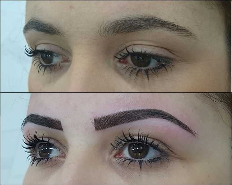 Transformation with Eyebrow Micropigmentation