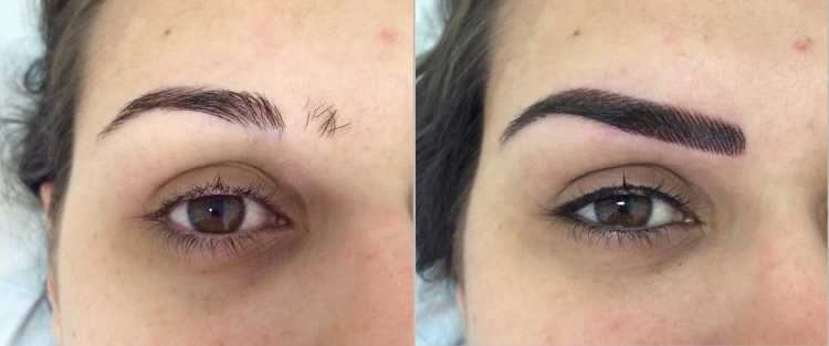 Photo to compare before and after eyebrow micropigmentation