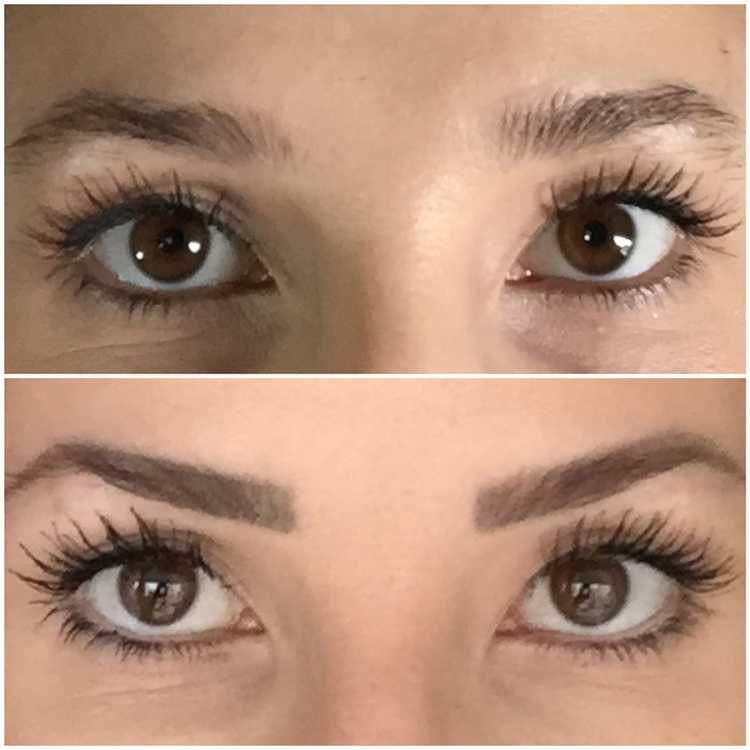 Eyebrow transformation