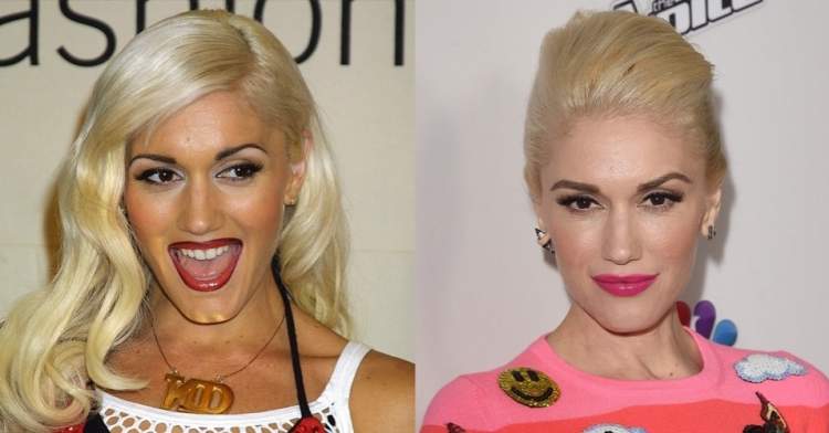 Gwen Stefani's Eyebrows - Before and After