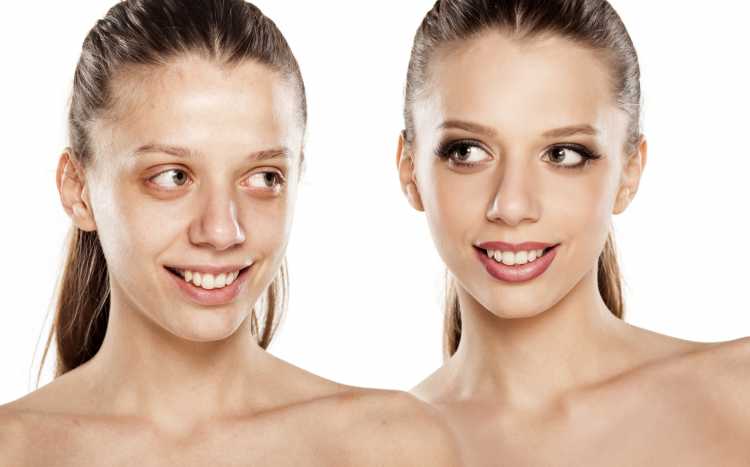 disguise blemishes on the face before and after