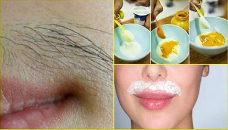 Recipe with egg, sugar and cornstarch to eliminate facial hair